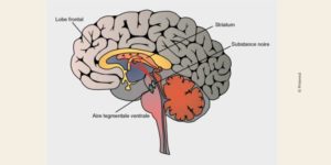 Image de cerveau